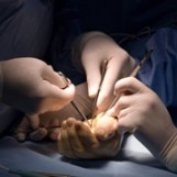 Hand Surgery Berks County